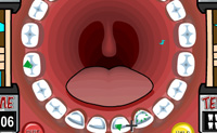 O  paciente tem gordura nos dentes e tens de garantir que esta gordura � removida antes que o dente apodre�a.