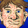 Squeezing Zits Games