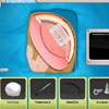 Operate Now: Epilepsy Surgery Games
